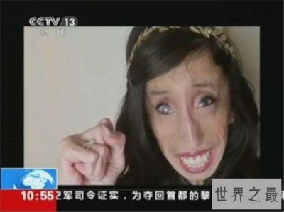 ​世界上最恶心的人是谁？曾出演电影《世界最丑人》