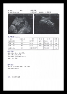 什么是胎儿超声测值?HC是啥意思?
