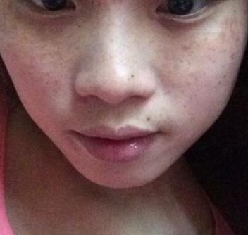 老祖宗留下来的方法,每天晚上抹一抹,只用五天斑点消失不见了