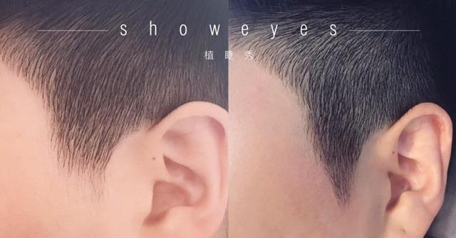 生活发量少怎么增加发量 秃发女孩必学发量激増6招 5