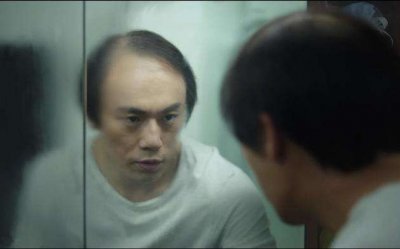 ​秦昊“秃头照”出圈，医生隔空看诊，“雄秃”，能治