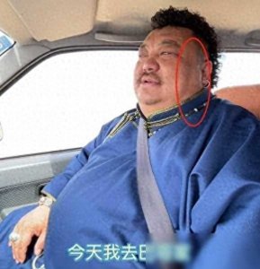 网红恩克不到半年吃掉110只羊，从不吃青菜，面色乌青疣扩散？